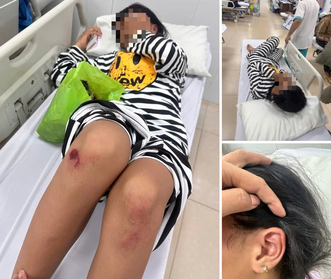 Nữ sinh lớp 6 bị đánh hội đồng ở Đắk Lắk: Vụ việc gây sốc trong trường học - Ảnh 1. Nữ sinh lớp 6 bị đánh hội đồng ở Đắk Lắk: Vụ việc gây sốc trong trường học - Ảnh 1.