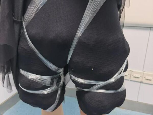 Ph&aacute;t hiện 58 con r&ugrave;a sống buộc quanh ch&acirc;n người phụ nữ tại cửa hải quan - Ảnh 1.