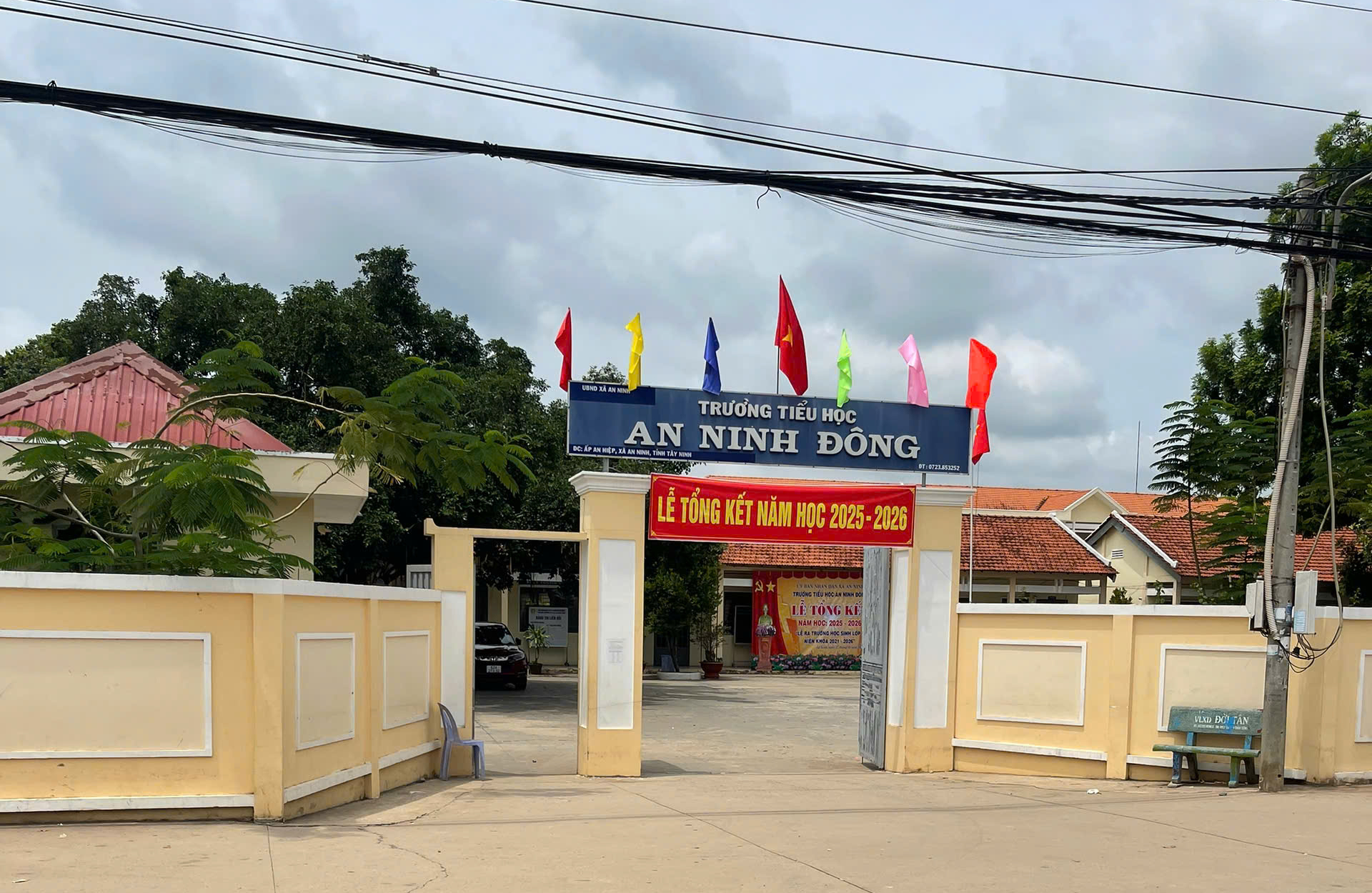 Trước ngày nghỉ hè, 1 nam sinh lớp 5 nhập viện cấp cứu vì bị bạn "tác động" - Ảnh 1.