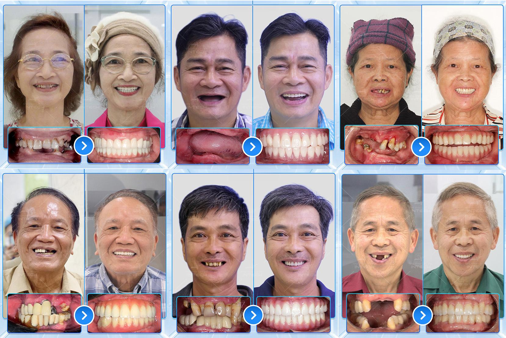 Định nghĩa bác sĩ nha khoa giỏi theo góc nhìn của CEO Nha khoa Lạc Việt Intech - Ảnh 3. Định nghĩa bác sĩ nha khoa giỏi theo góc nhìn của CEO Nha khoa Lạc Việt Intech - Ảnh 3.