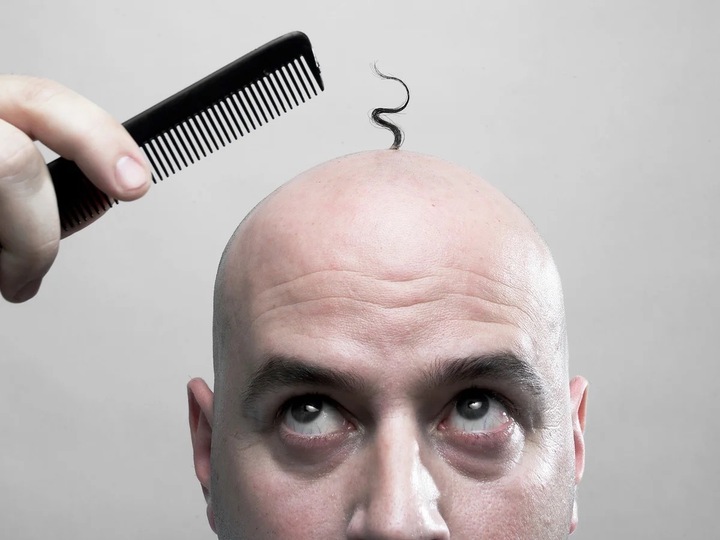 Quốc gia n&agrave;o c&oacute; nhiều người h&oacute;i nhất thế giới? - Ảnh 1.