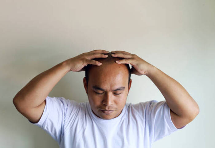 Quốc gia n&agrave;o c&oacute; nhiều người h&oacute;i nhất thế giới? - Ảnh 2.