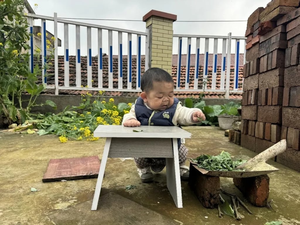 Cảm động t&igrave;nh em g&aacute;i nu&ocirc;i anh trai 25 tuổi mang h&igrave;nh h&agrave;i "trẻ sơ sinh" - Ảnh 6.