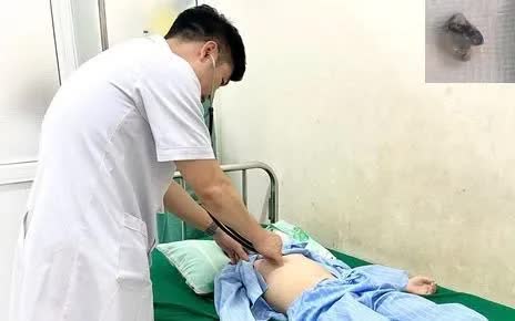 Nguy hiểm: Nhổ răng tại nh&agrave;, b&eacute; trai nguy kịch v&igrave; răng rơi v&agrave;o phổi - Ảnh 1.