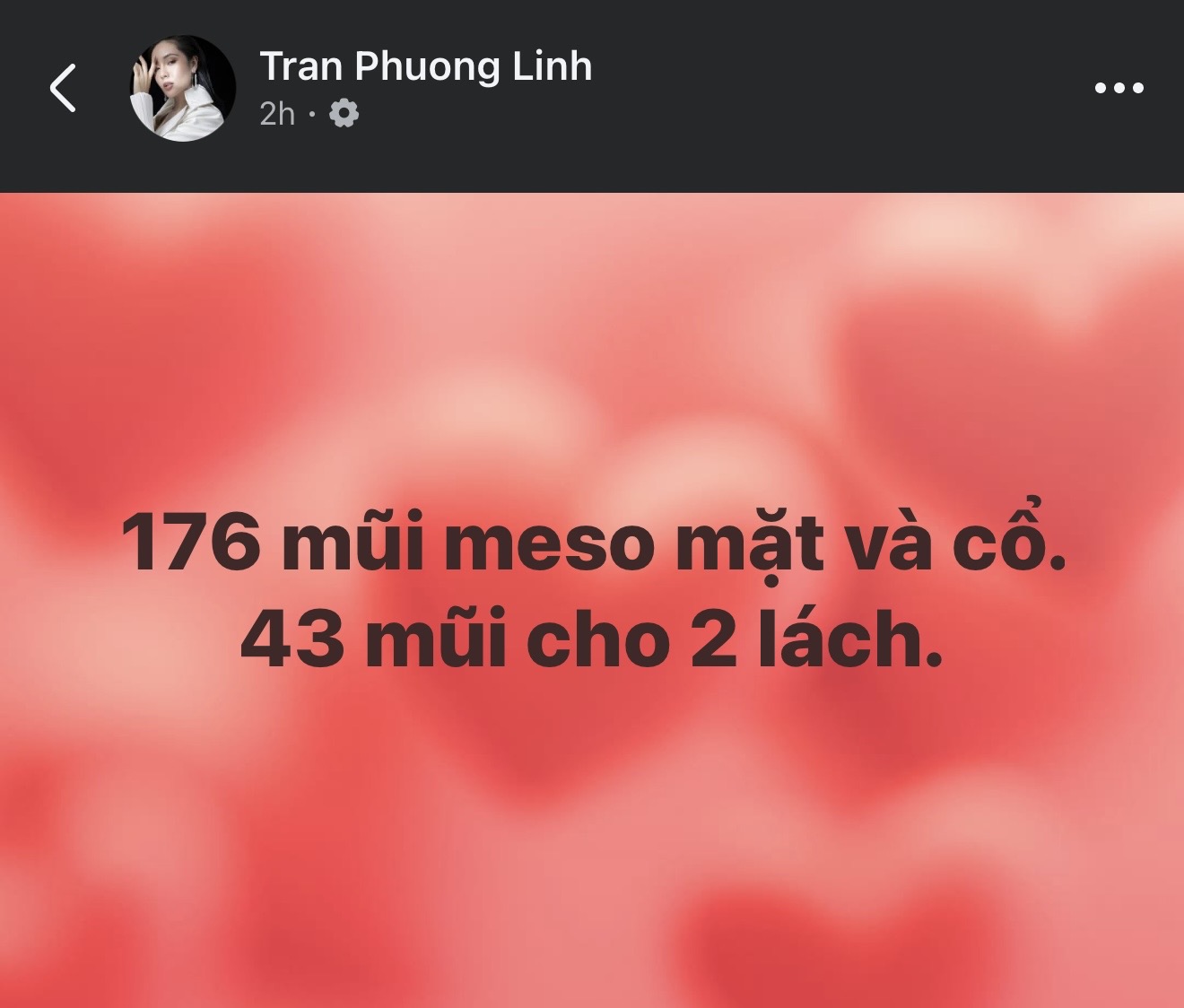  - Ảnh 2.