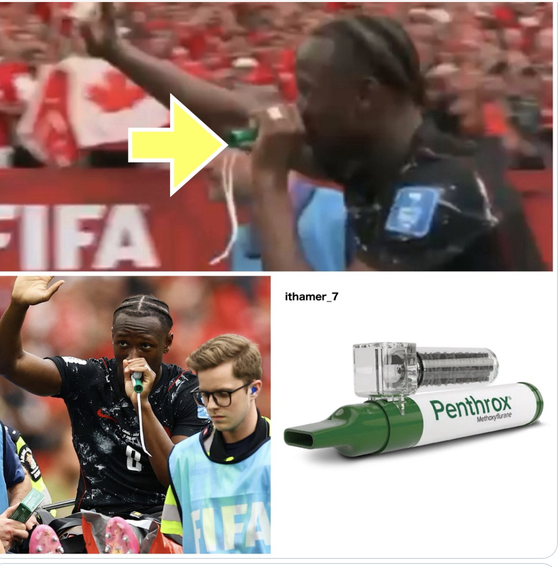 Ng&ocirc;i sao Canada g&atilde;y ch&acirc;n r&ugrave;ng rợn ở World Cup h&iacute;t c&aacute;i g&igrave; m&agrave;u xanh?- Ảnh 1.