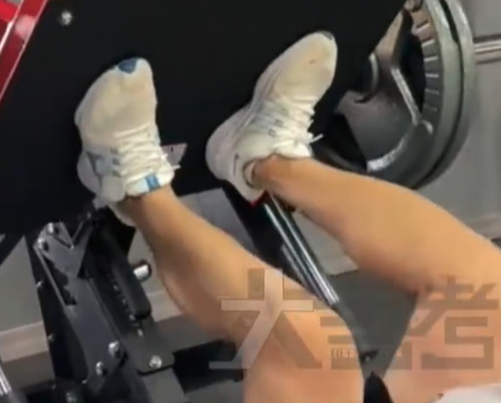 Nam thanh ni&ecirc;n 23 tuổi suy thận cấp sau khi tập gym, chỉ số tổn thương cơ tăng gấp 100 lần - Ảnh 1.
