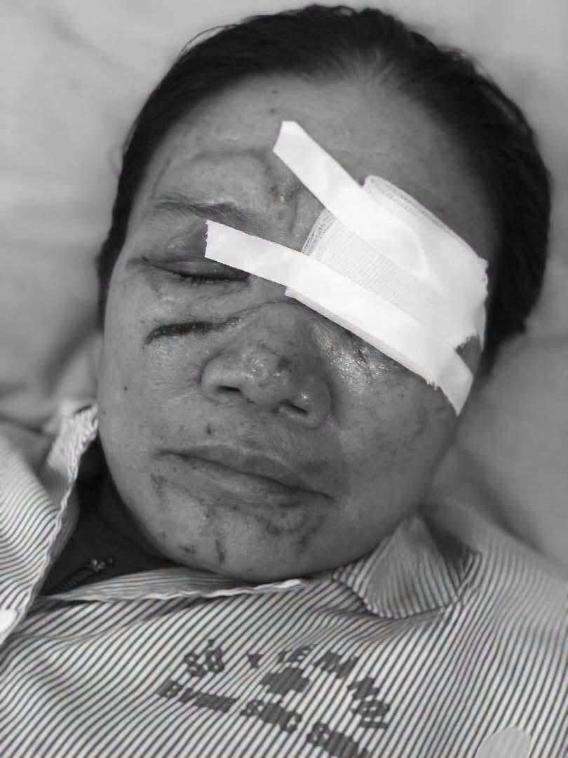 Chủ quán hải sản xịt nước khiến cụ bà bán rau chảy máu mắt: Mong giải quyết theo hướng tình cảm - Ảnh 3.