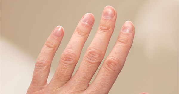 Nghi&ecirc;n cứu 10 triệu người: Loại thực phẩm nhiều người ăn mỗi ng&agrave;y li&ecirc;n quan hơn 30 bệnh, c&oacute; ung thư v&agrave; tiểu đường - Ảnh 2.