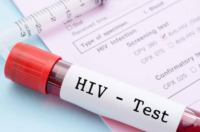 Người đàn ông giấu kín bệnh HIV để làm 