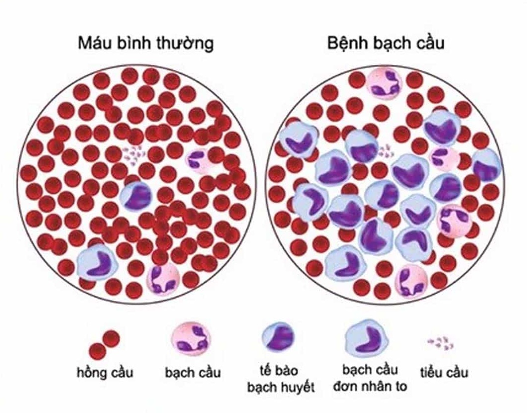  - Ảnh 2.
