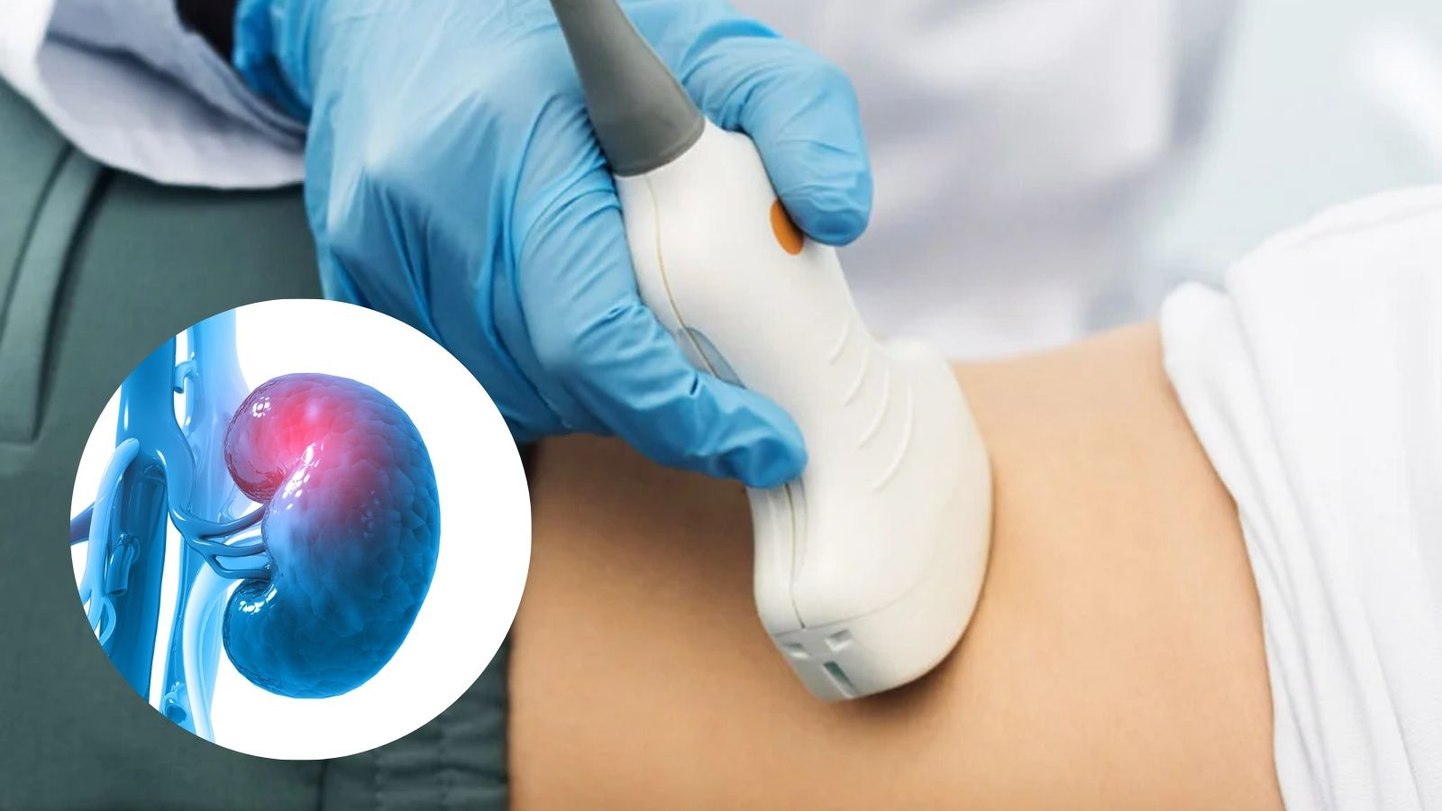 Người đ&agrave;n &ocirc;ng bất ngờ ph&aacute;t hiện ung thư thận khi đi kh&aacute;m sức khỏe định kỳ: T&ocirc;i mới 32 tuổi, sao c&oacute; thể... - Ảnh 1.