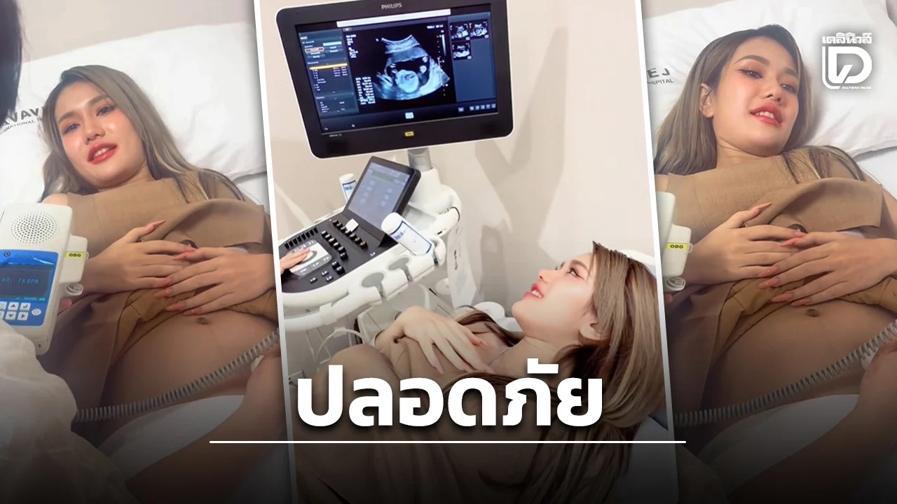  - Ảnh 3.