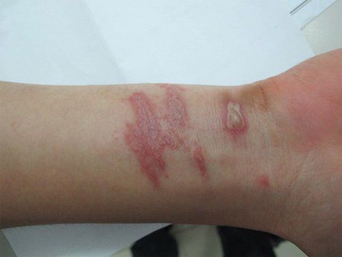Vừa ngủ dậy thấy