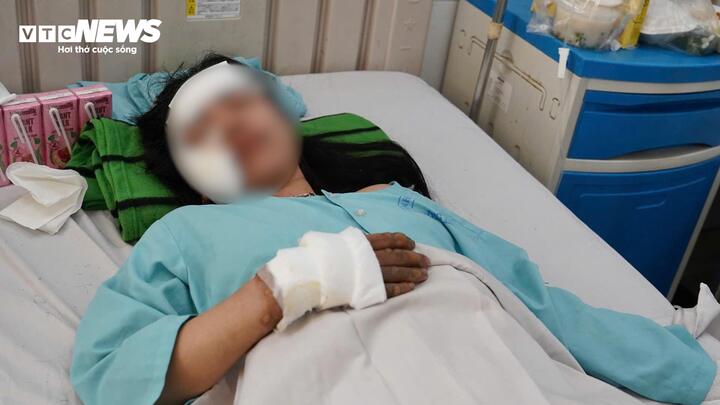Nạn nh&acirc;n sống s&oacute;t kể lại vụ ch&aacute;y xe kh&aacute;ch Đồng Nai , 7 người thiệt mạng - Ảnh 3.