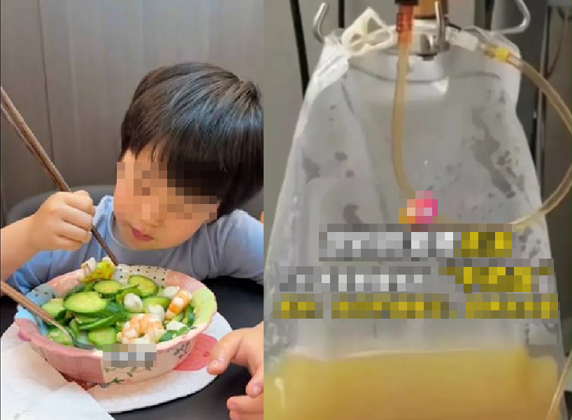 Cậu b&eacute; 5 tuổi m&aacute;u "trắng đục như sữa" v&igrave; một m&oacute;n canh nhiều gia đ&igrave;nh cho con nhỏ uống mỗi ng&agrave;y - Ảnh 1.