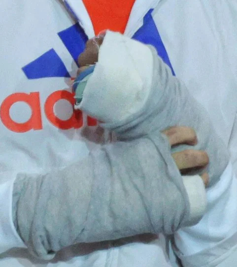  - Ảnh 4.