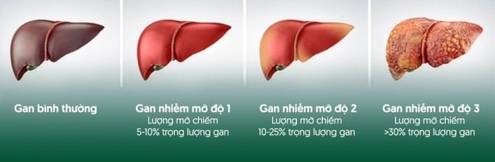  - Ảnh 1.