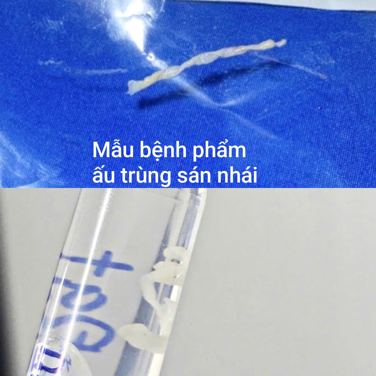 - Ảnh 1. - Ảnh 1.