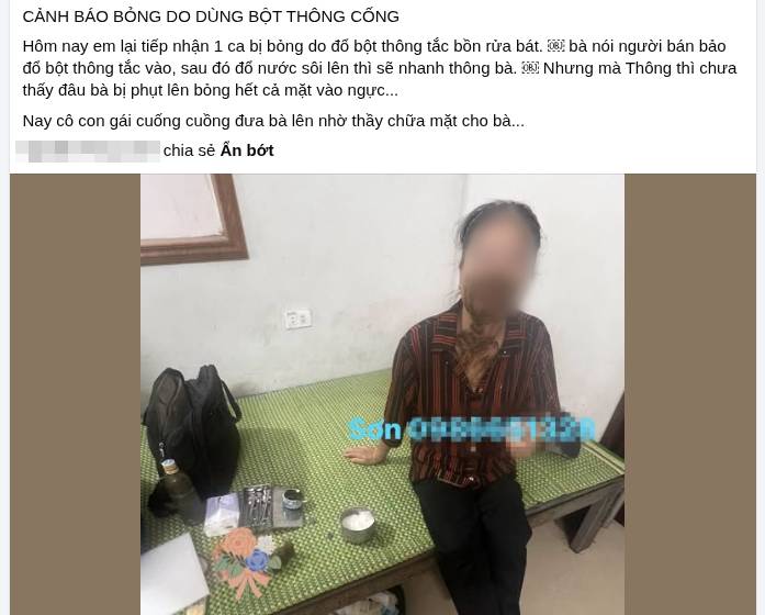 Rùng mình thói quen dọn nhà "tưởng vô hại": Đổ thứ bột quen thuộc này xuống cống, nhiều người bất ngờ bị bỏng, sẹo chằng chịt- Ảnh 1.