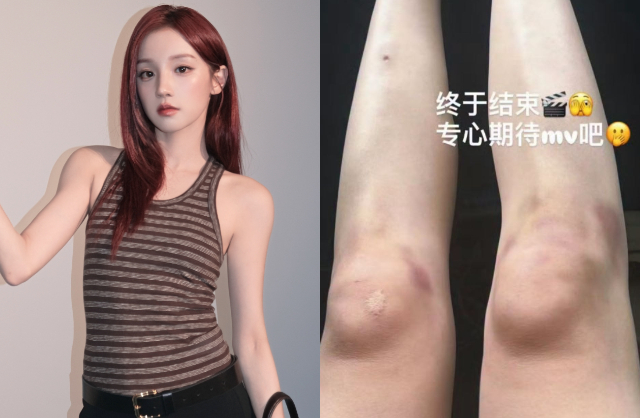  - Ảnh 1.