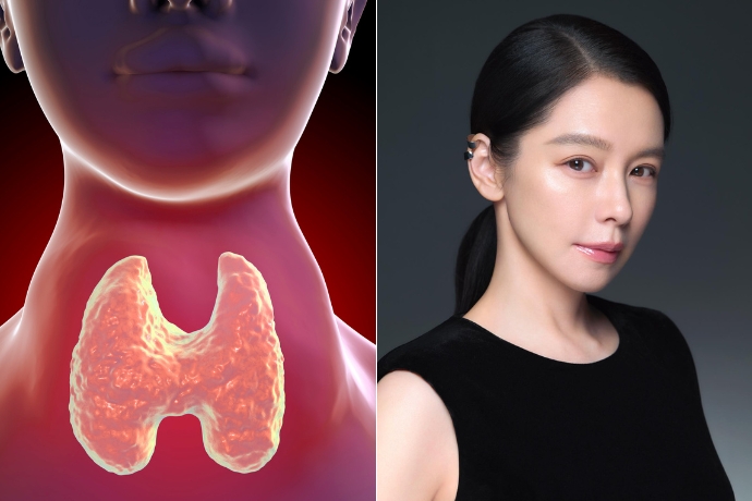 Tuyến giáp rất ghét bạn làm 5 việc này, bạn đang mắc bao nhiêu cái? - Ảnh 4.