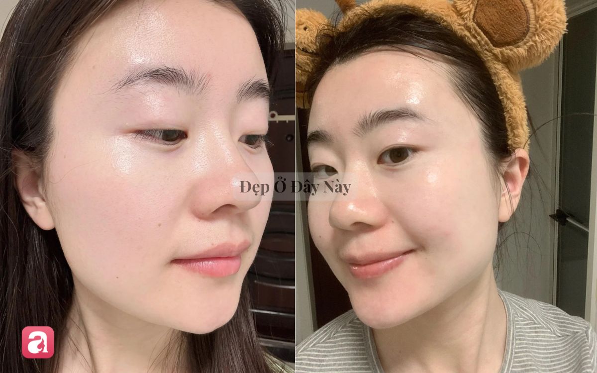 V&igrave; sao dưỡng da qu&aacute; nhiều lại c&oacute; thể khiến l&agrave;n da ng&agrave;y c&agrave;ng xấu đi?- Ảnh 2.