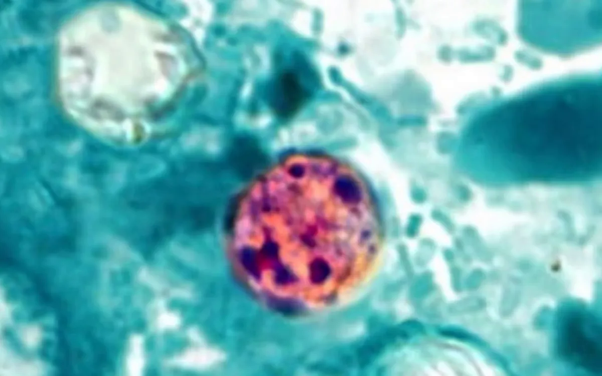 Mỹ ghi nhận ca tử vong đầu ti&ecirc;n li&ecirc;n quan đến đợt dịch Cyclospora - Ảnh 1.
