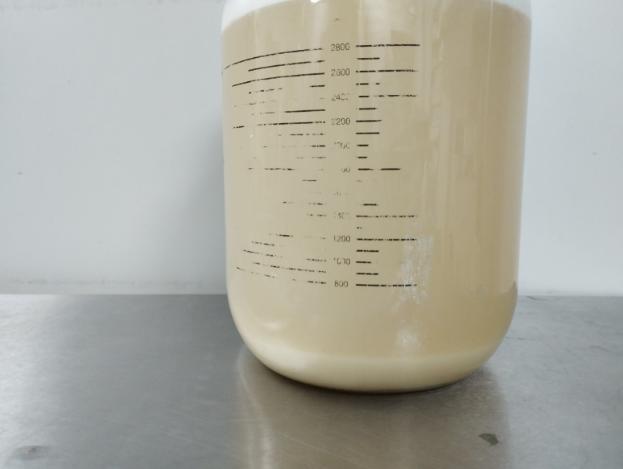 B&eacute; g&aacute;i 6 tuổi ho suốt 2 th&aacute;ng, phổi chứa đầy dịch trắng như sữa: B&aacute;c sĩ l&ecirc;n tiếng cảnh b&aacute;o- Ảnh 2.