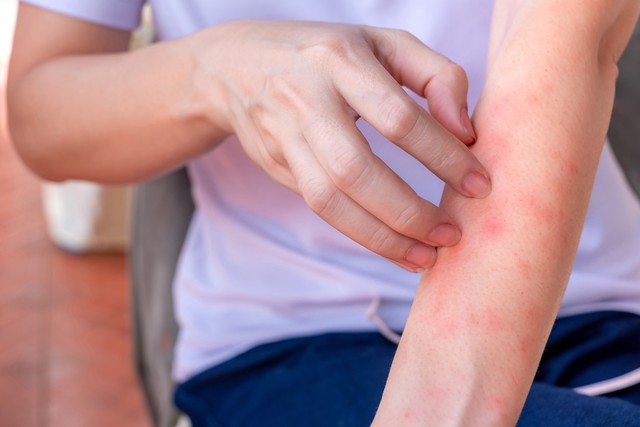 Nếu bạn có hai vùng da bị ngứa dai dẳng trên cơ thể, hãy cảnh giác vì đó có thể là dấu hiệu của ung thư gan - Ảnh 1.