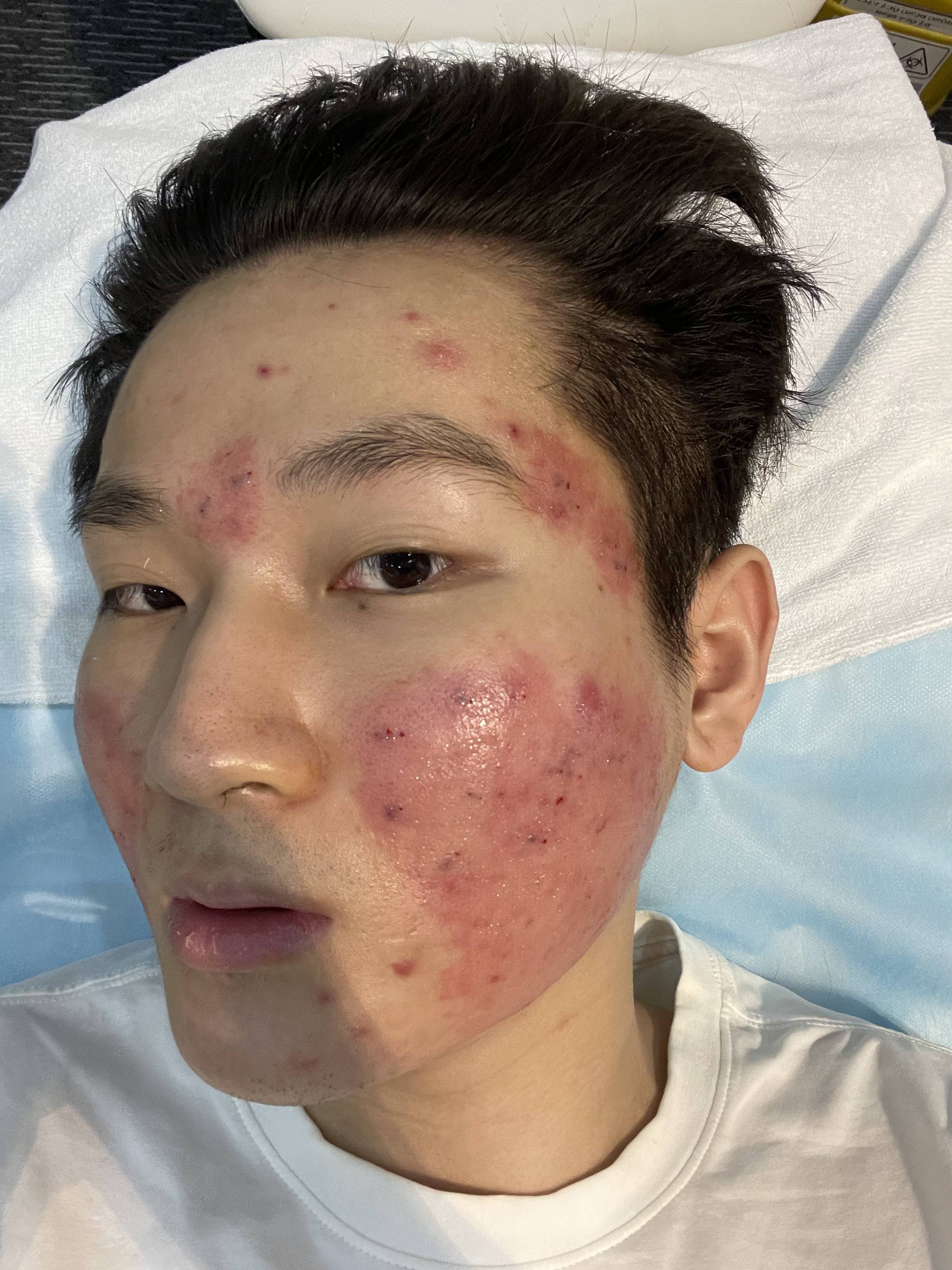 Hành trình thành Beauty Blogger của Bimm và 3 bức ảnh từng không dám cho ai nhìn thấy - Ảnh 2. Hành trình thành Beauty Blogger của Bimm và 3 bức ảnh từng không dám cho ai nhìn thấy - Ảnh 2.