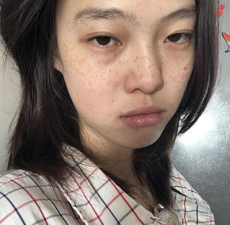  - Ảnh 2.