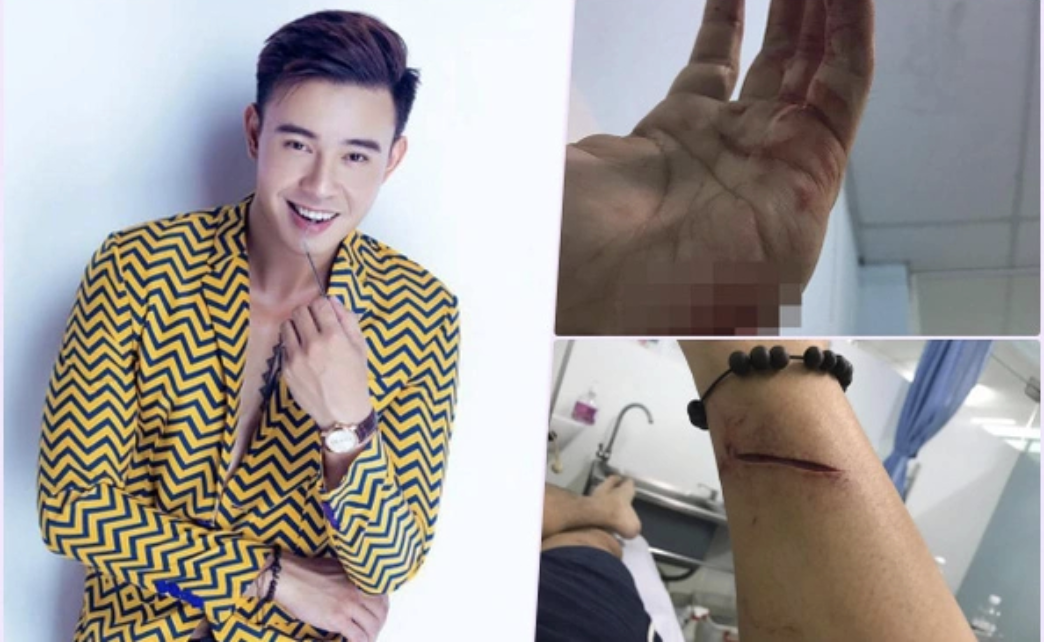 Đông Hùng trở lại mạnh mẽ với ca khúc 10 tỷ view và hành trình vượt khó ở tuổi 20 - Ảnh 5. Đông Hùng trở lại mạnh mẽ với ca khúc 10 tỷ view và hành trình vượt khó ở tuổi 20 - Ảnh 5.