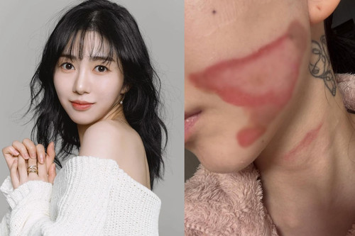 Kwon Mina tố chị gái lừa đảo hàng chục tỷ đồng và ngược đãi mẹ - Ảnh 5. Kwon Mina tố chị gái lừa đảo hàng chục tỷ đồng và ngược đãi mẹ - Ảnh 5.