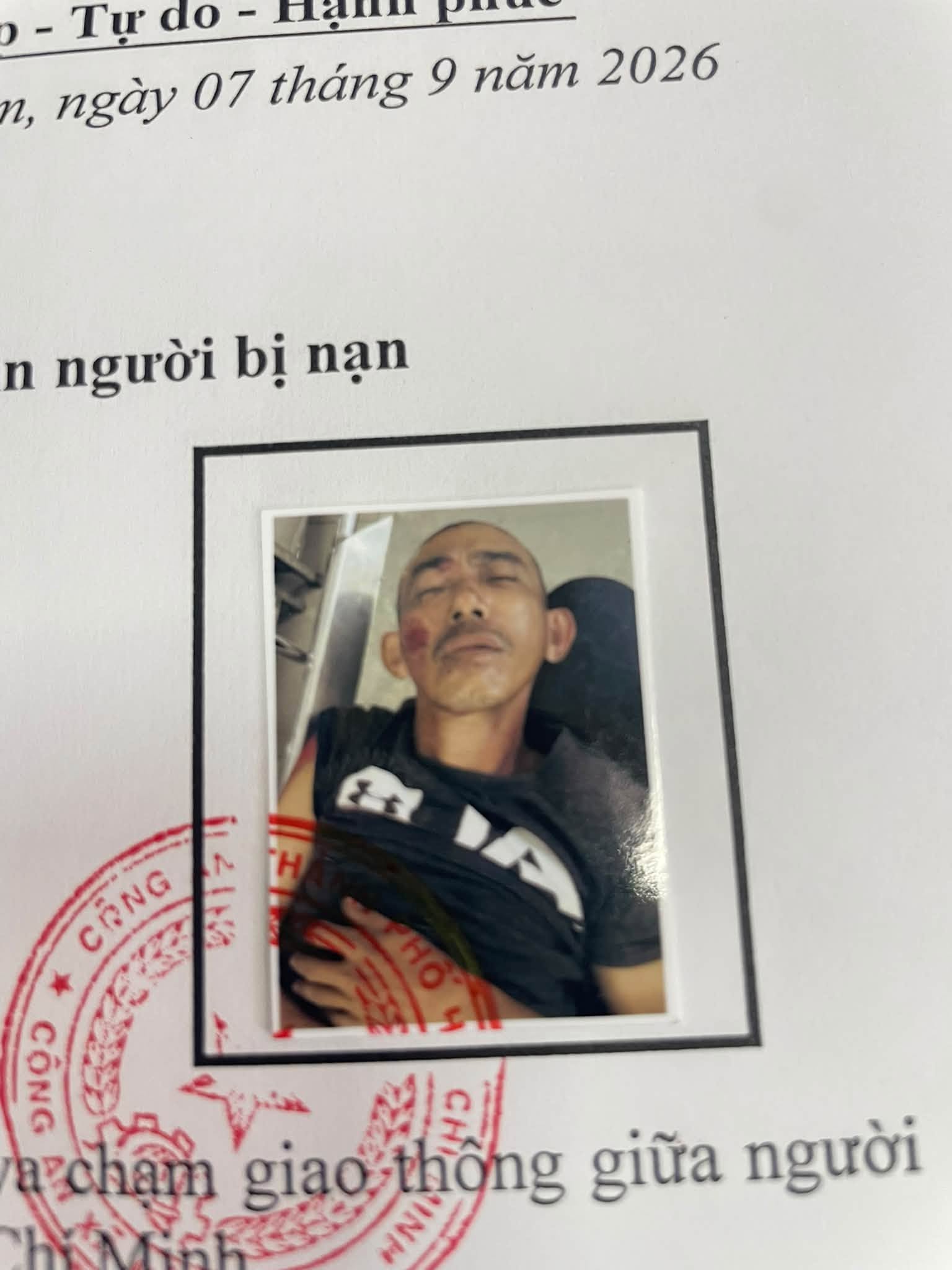 Người đ&agrave;n &ocirc;ng chấn thương b&ecirc;n lề đường B&igrave;nh Ba: C&ocirc;ng an t&igrave;m người th&acirc;n khẩn cấp - Ảnh 1.
