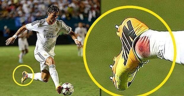 
	Cris Ronaldo chấn thương mắt cá chân vẫn nén đau thi đấu với Chelsea