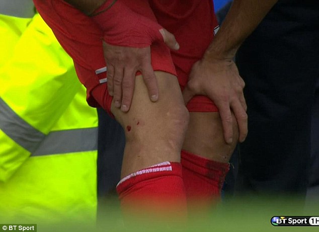 
	Suarez bị đau sau tình huống va chạm ghê rợn