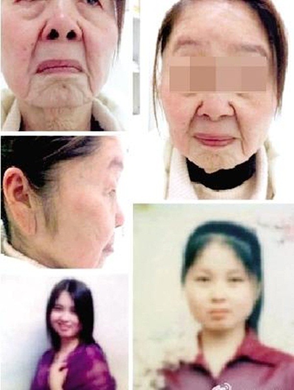 Trung Quốc: 28 tuổi nhìn như... cụ bà 80 1