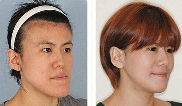 Hàn Quốc: Cô gái xấu xí bỗng chốc trở thành người đẹp 9