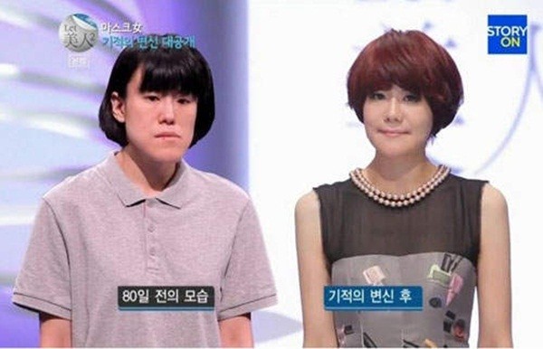 Hàn Quốc: Cô gái xấu xí bỗng chốc trở thành người đẹp 10