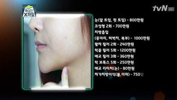 Hàn Quốc: Cô nàng mặt nhọn như người ngoài hành tinh 2