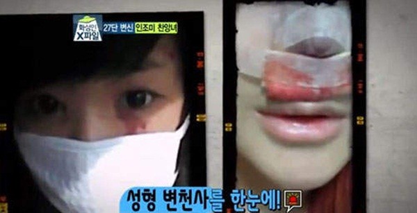 Hàn Quốc: Cô nàng mặt nhọn như người ngoài hành tinh 5