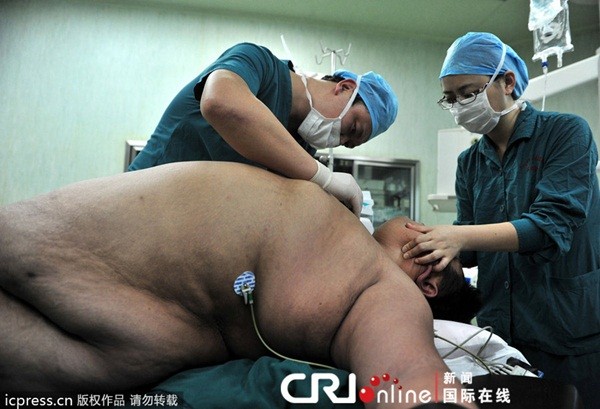 Trung Quốc: Quá to béo nên phải cắt bỏ... 90% dạ dày 3