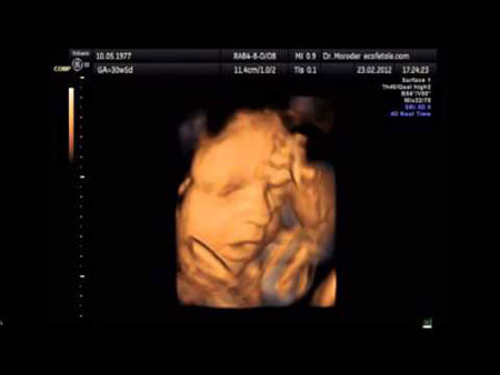 
	Hình ảnh chụp từ video "Bằng chứng thai nhi ngáp trong bụng mẹ"