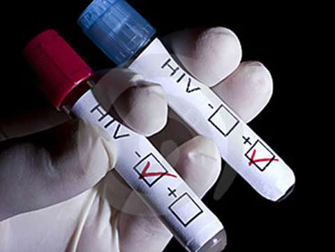 Hành trình chế ngự virus HIV