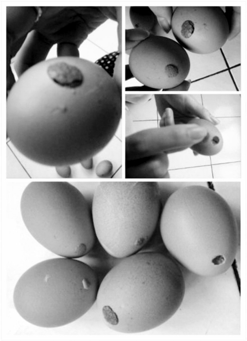 Trứng cũng mọc... mụn trứng cá 1