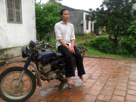 Lạng Sơn: Nam thanh niên biến thành "phụ nữ" sau khi ốm nặng 1