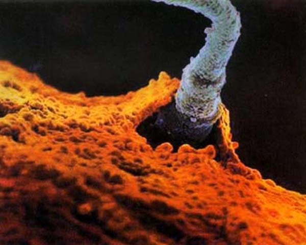 "Soi" quá trình thụ thai dưới ống kính hiển vi 7