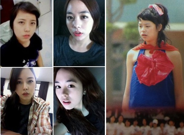 Lộ ảnh quá khứ, tân Hoa hậu Hàn bị nghi đã đụng "dao kéo" 5