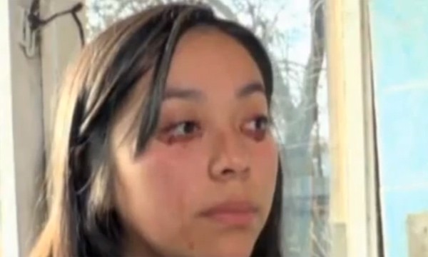 Chile: Cô gái trẻ bỗng nhiên khóc ra máu